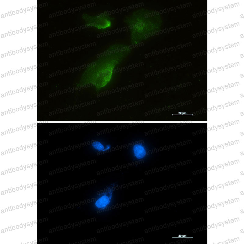 Anti-GOT1 Antibody (R1Q28)
