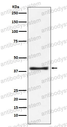 Anti-GOT1 Antibody (R1Q27)