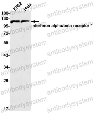 Anti-Interferon alpha/beta Receptor 1 Antibody (R1Q29)
