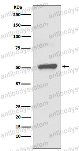 Anti-BPI Antibody (R1Q30)