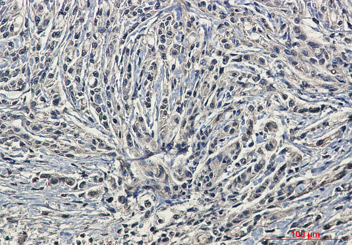 Anti-Phospho-PRKCA/PKC alpha (Ser657) Antibody (R1Q33)