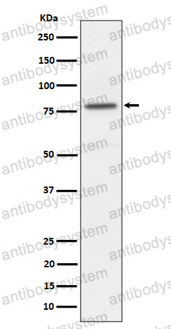 Anti-Phospho-PRKCA (T497) Antibody (R1Q32)