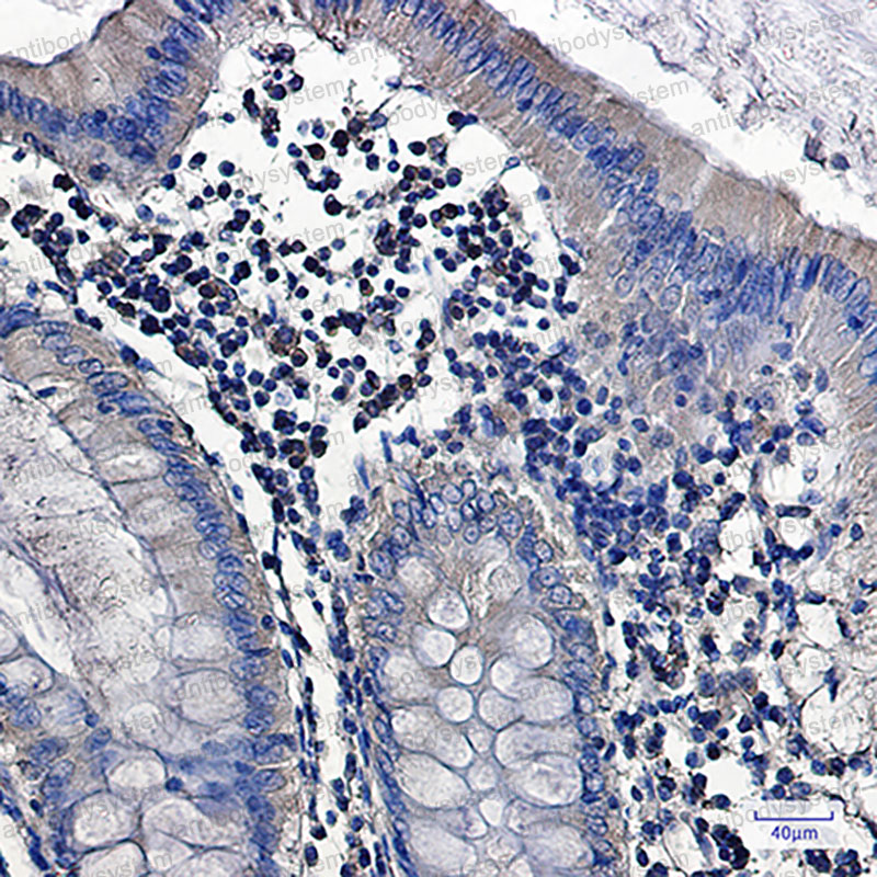 Anti-PRKCA Antibody (R1Q36)