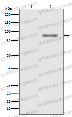 Anti-Phospho-PRKCA (T638) Antibody (R1Q31)