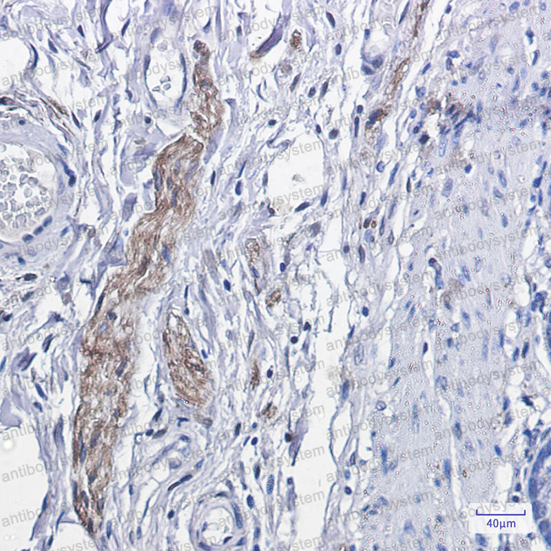 Anti-Phospho-PRKCA/PKC alpha (Thr638) Antibody (R1Q34)