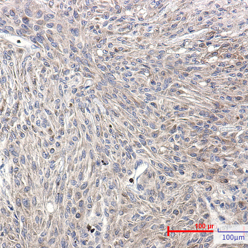 Anti-Phospho-PRKCA (Ser660) Antibody (R1Q35)