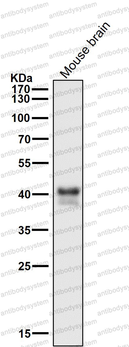 Anti-JUNB Antibody (R1Q37)