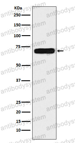Anti-NPR3 Antibody (R1Q40)