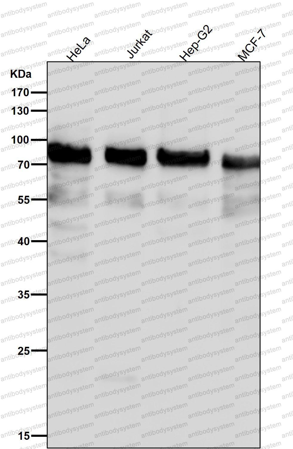 Anti-Phospho-UBTF (S484) Antibody (R1Q42)