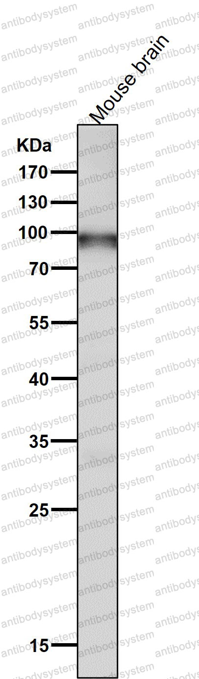 Anti-UBTF Antibody (R1Q41)