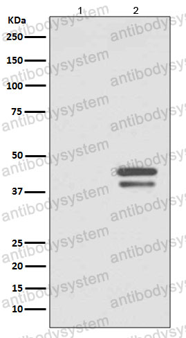 Anti-Phospho-JUND (S255) Antibody (R1Q44)