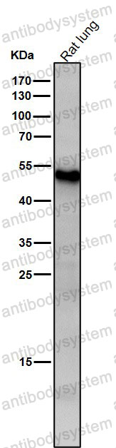 Anti-ATF7 Antibody (R1Q47)