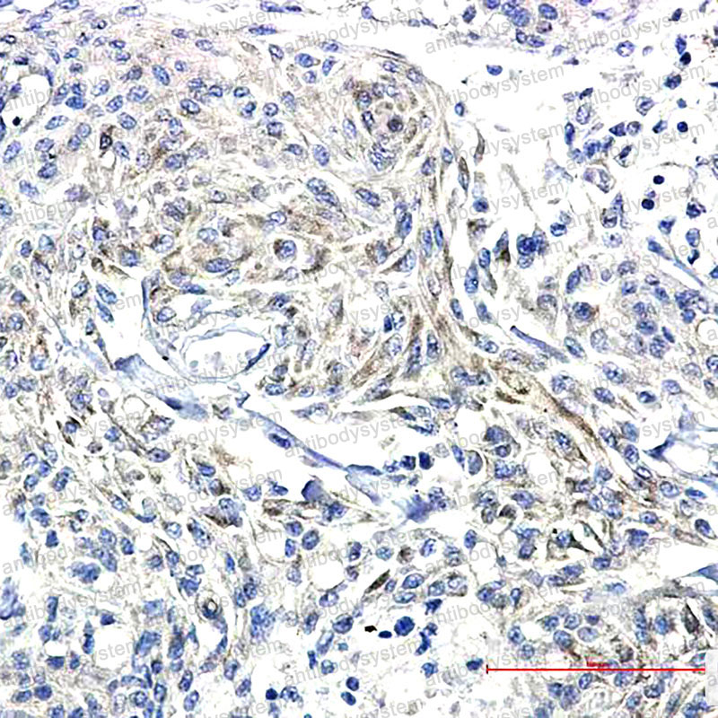Anti-Phospho-SYN1/Synapsin I (Ser9) Antibody (R1Q48)