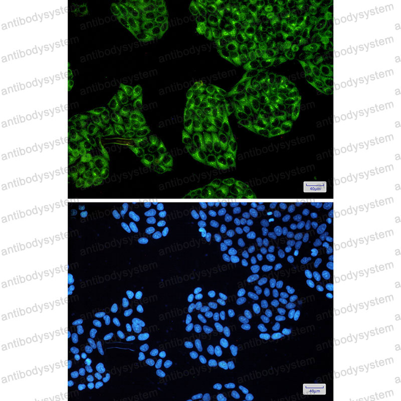 Anti-PRKACA Antibody (R1Q49)