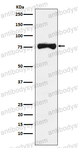 Anti-TYRP1 Antibody (R1Q50)