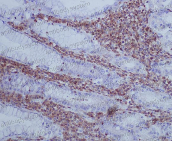 Anti-GAP43 Antibody (R1Q51)