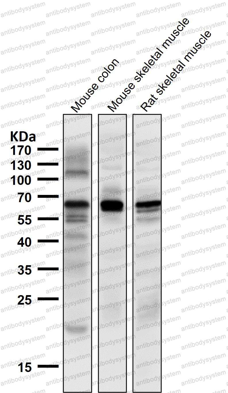 Anti-TPH1 Antibody (R1C55)