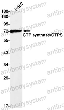 Anti-CTPS1 Antibody (R1Q54)