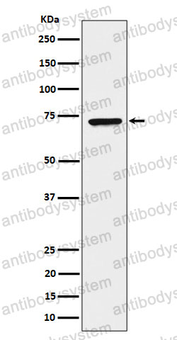 Anti-CTPS1 Antibody (R1Q53)