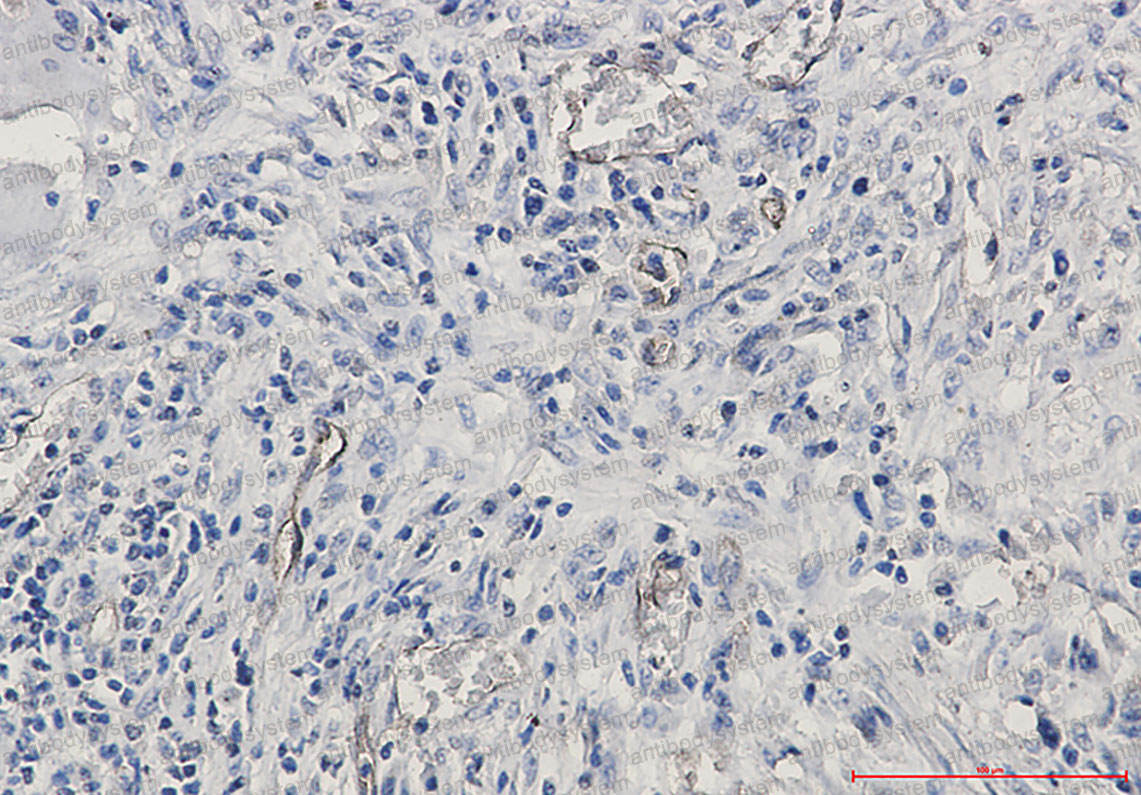 Anti-CD105/ENG Antibody (R1Q55)