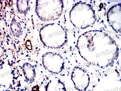 Immunohistochemical for Anti-CD105/ENG Antibody (R3E82) ?>