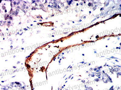 Immunohistochemical for Anti-CD105/ENG Antibody (R3E82) ?>