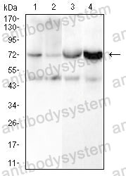 Western blot for Anti-CD105/ENG Antibody (R3E82) ?>