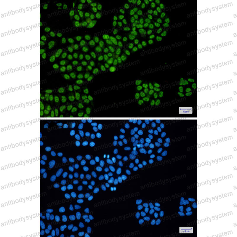 Anti-DDX5 Antibody (R1Q56)