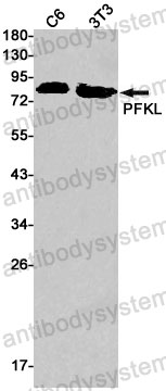 Anti-PFKL Antibody (R1Q57)