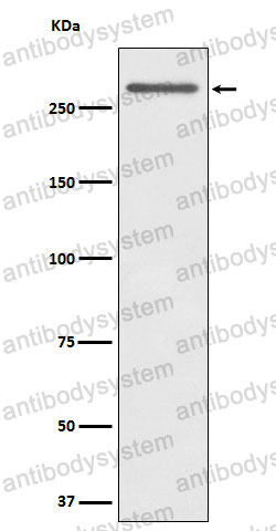Anti-CD35/CR1 Antibody (R1Q60)