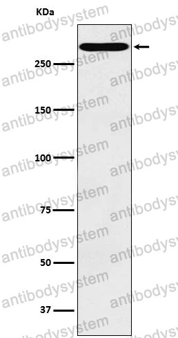 Anti-CD35/CR1 Antibody (R1Q59)