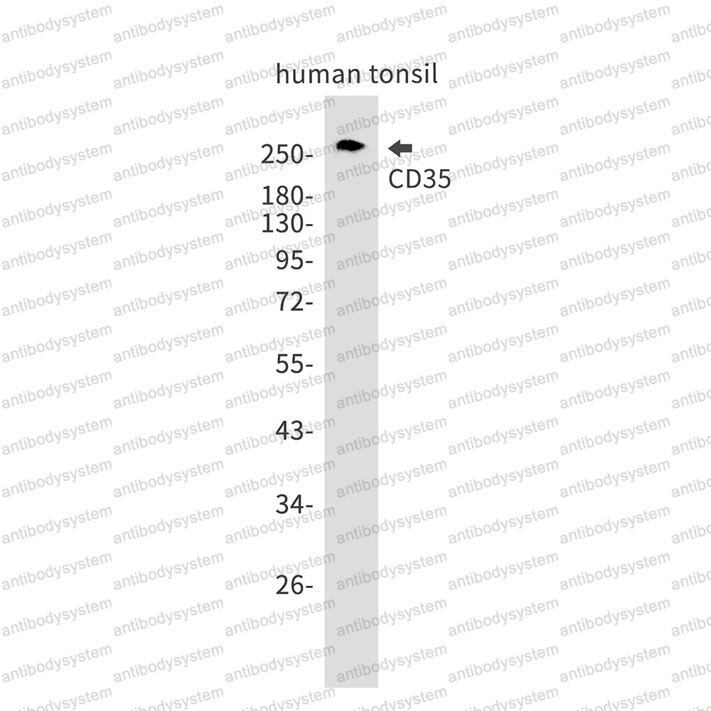 Anti-CD35/CR1 Antibody (R1Q61)