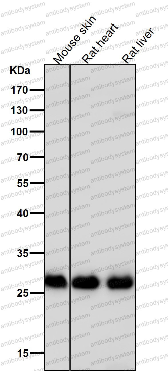 Anti-LGALS3/Galectin-3 Antibody (R1Q62)