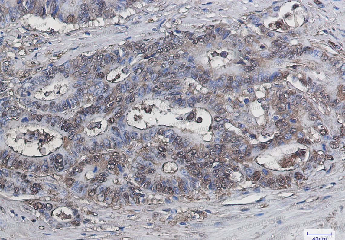Anti-LGALS3/Galectin-3 Antibody (R1Q63)