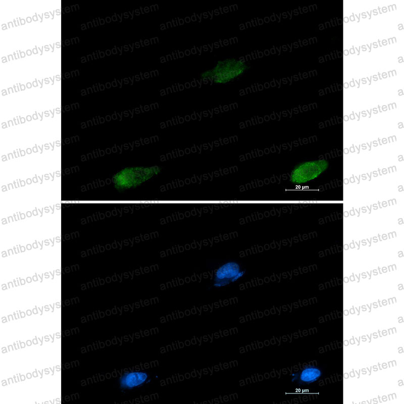 Anti-LGALS3/Galectin-3 Antibody (R1Q64)