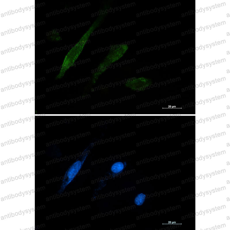 Anti-LGALS3/Galectin-3 Antibody (R1Q65)