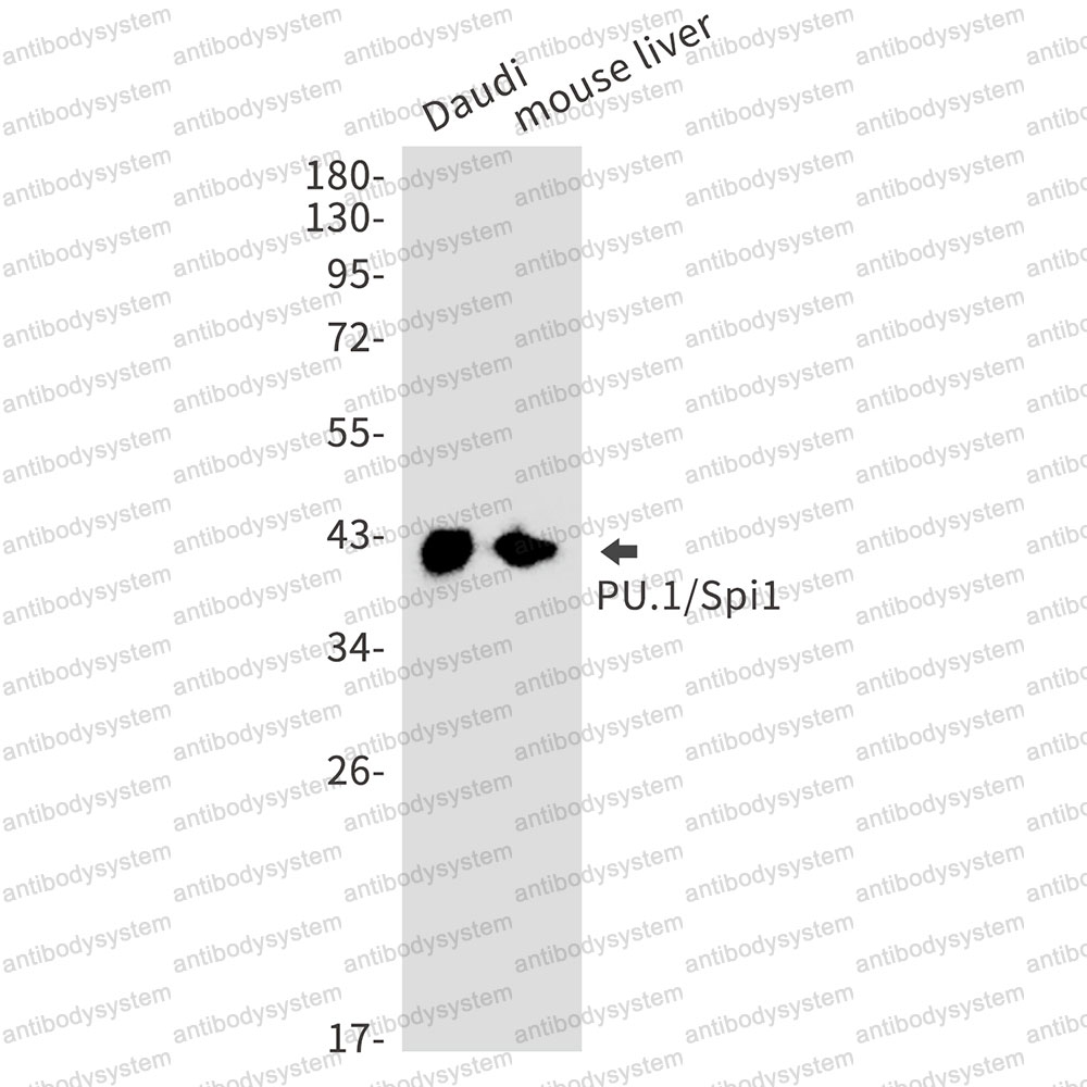 Anti-SPI1 Antibody (R1Q66)