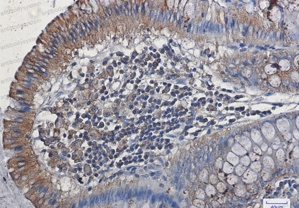 Anti-FLT1/VEGFR1 Antibody (R1Q68)
