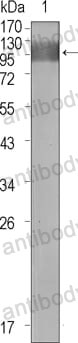 Anti-FLT1/VEGFR1 Antibody (R3E91)