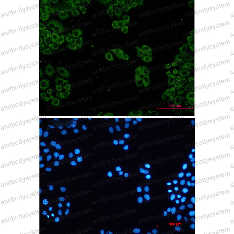 Anti-TCP1/CCTA Antibody (R1Q70)