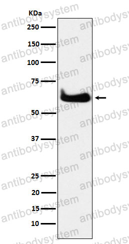 Anti-TCP1/CCTA Antibody (R1Q69)