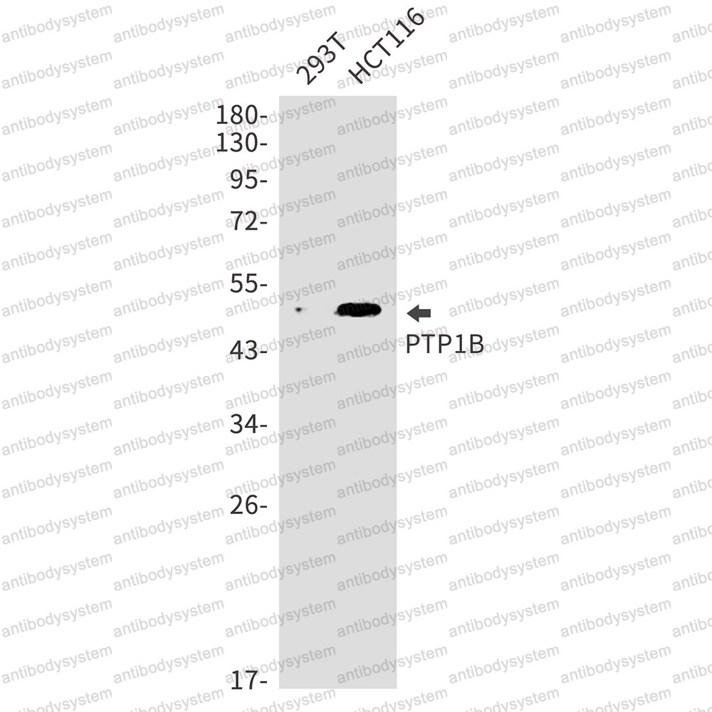 Anti-PTPN1 Antibody (R1Q74)