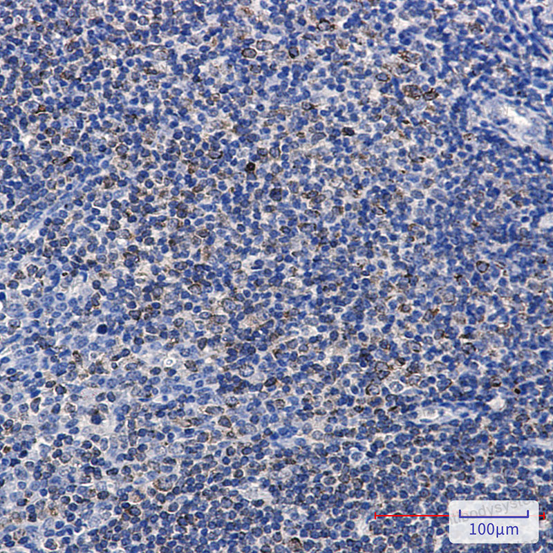 Anti-Phospho-PTPN1 (Ser378) Antibody (R1Q73)