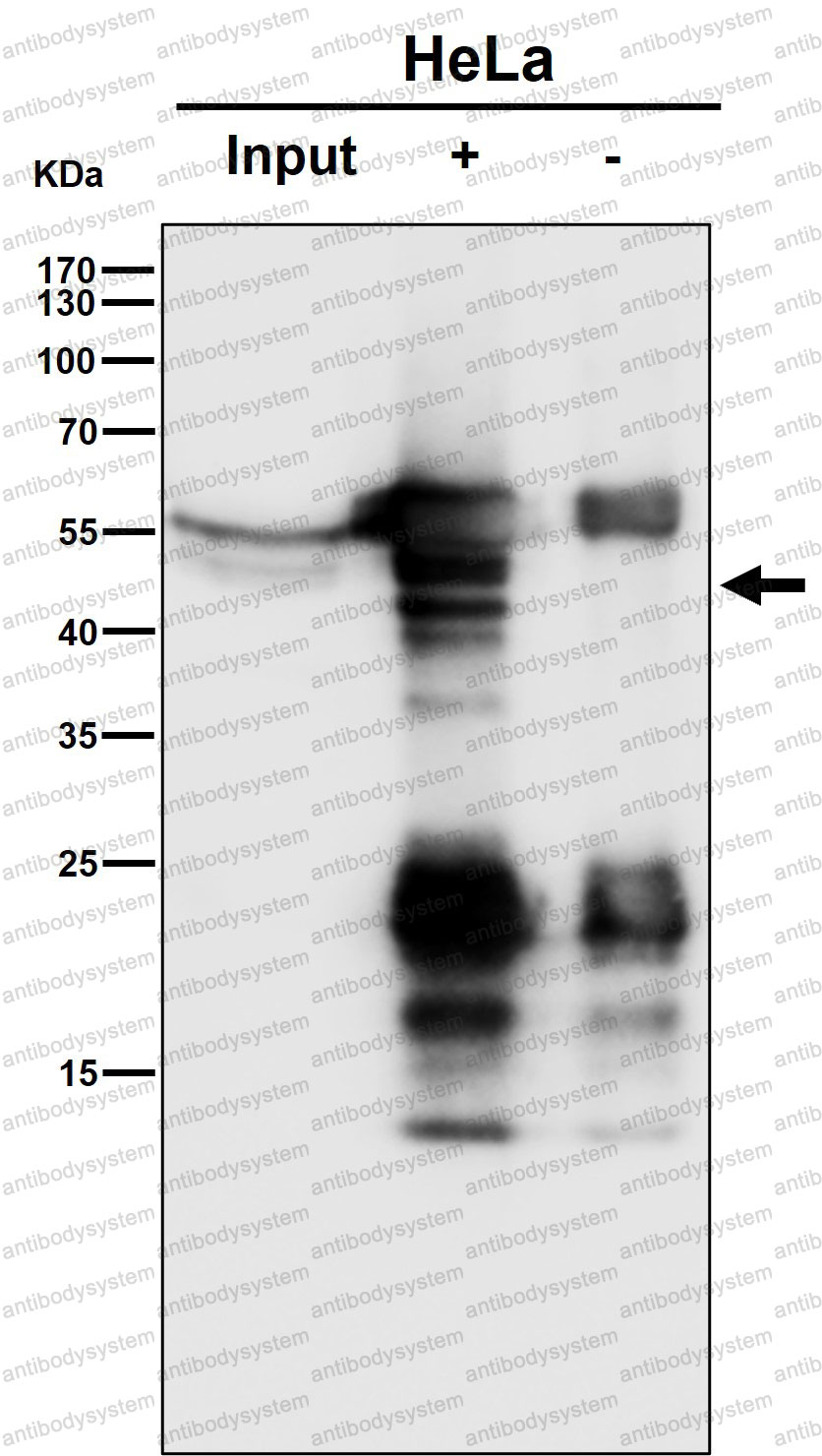 Anti-PTPN1/2 Antibody (R1Q71)