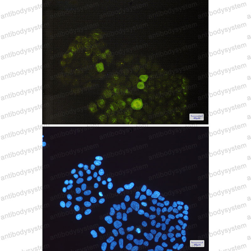 Anti-Phospho-PTPN1 (Ser352) Antibody (R1Q72)