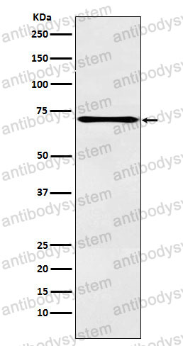 Anti-ALOX12 Antibody (R1Q75)
