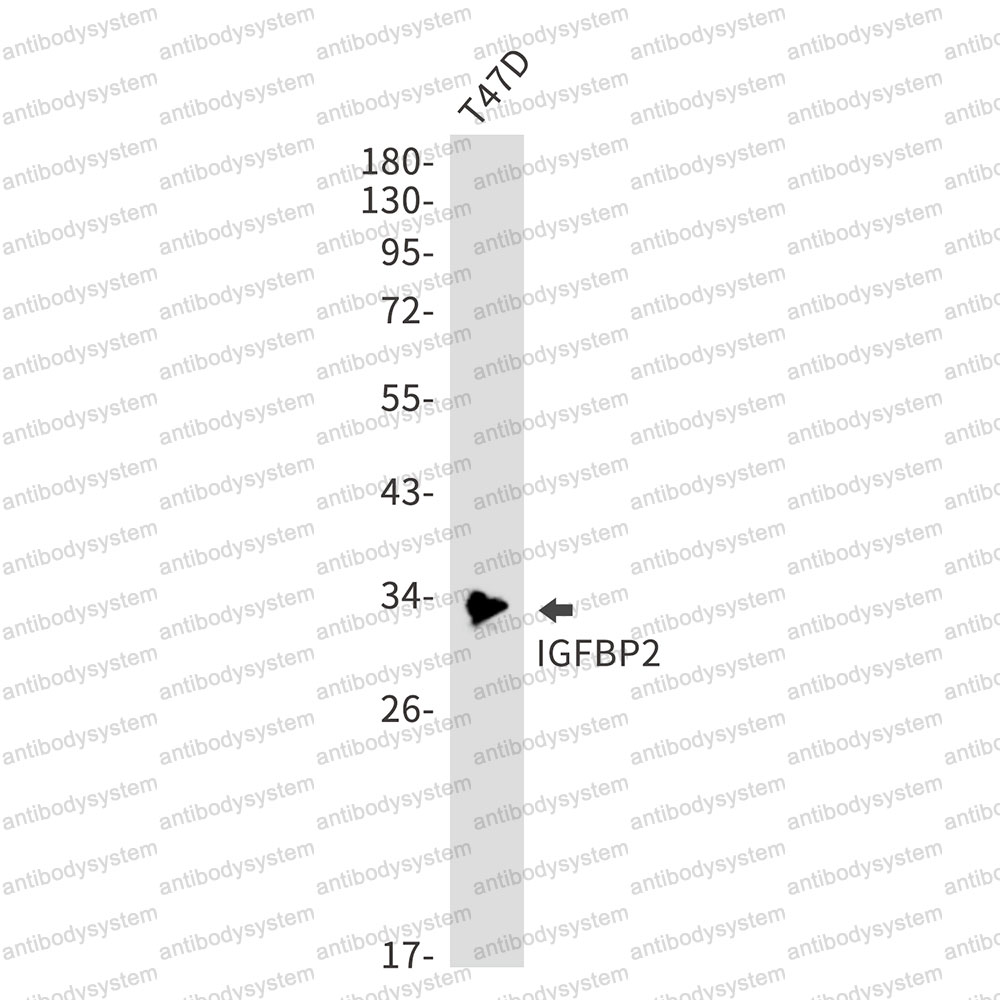 Anti-IGFBP2 Antibody (R1Q76)