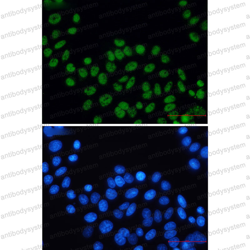 Anti-ERCC2 Antibody (R1Q78)