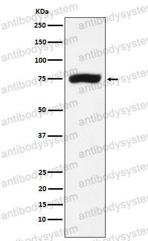 Anti-ERCC2 Antibody (R1Q77)