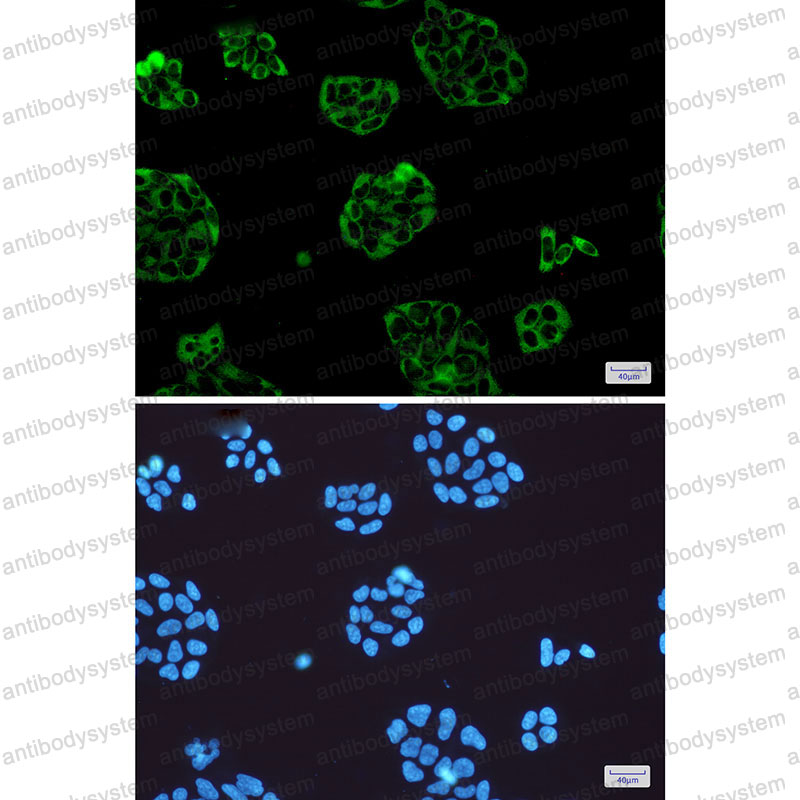 Anti-VCL Antibody (R1Q81)